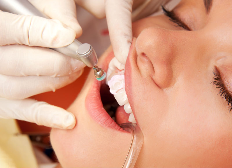 Finding Routine, But Reliable, Teeth Cleaning Midwest City OK