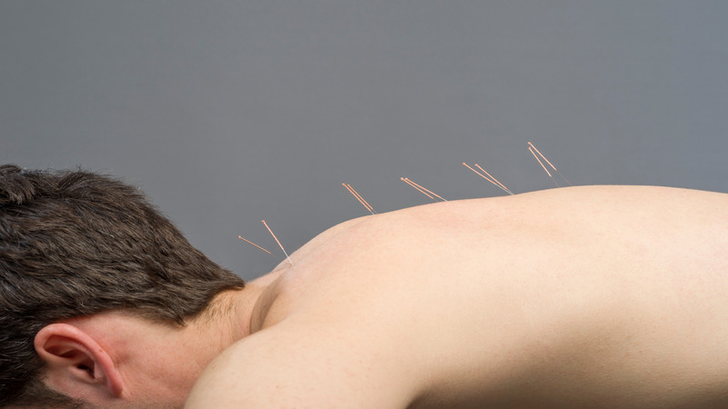 Experience Natural Relief With Acupuncture For Stress in Bellingham, WA Local Residents Trust