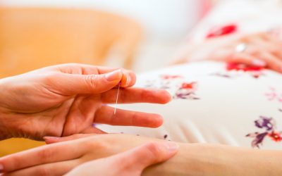 Manage Chronic Discomfort With Acupuncture For Pain In Sudden Valley, WA, Solutions That Work Fast